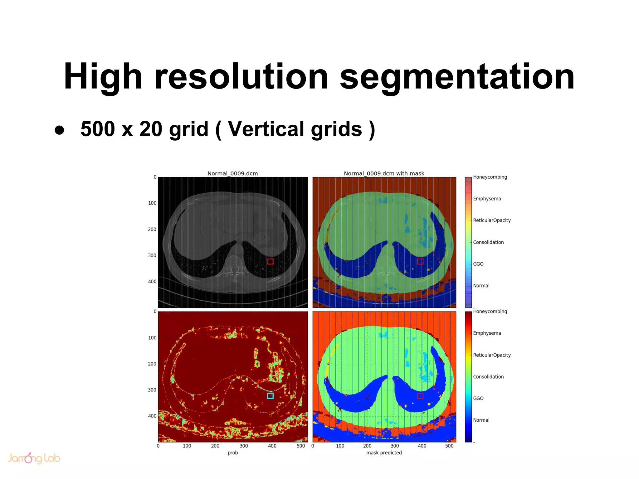 High resolution segmentation
● 500 x 20 grid ( Vertical grids )
 