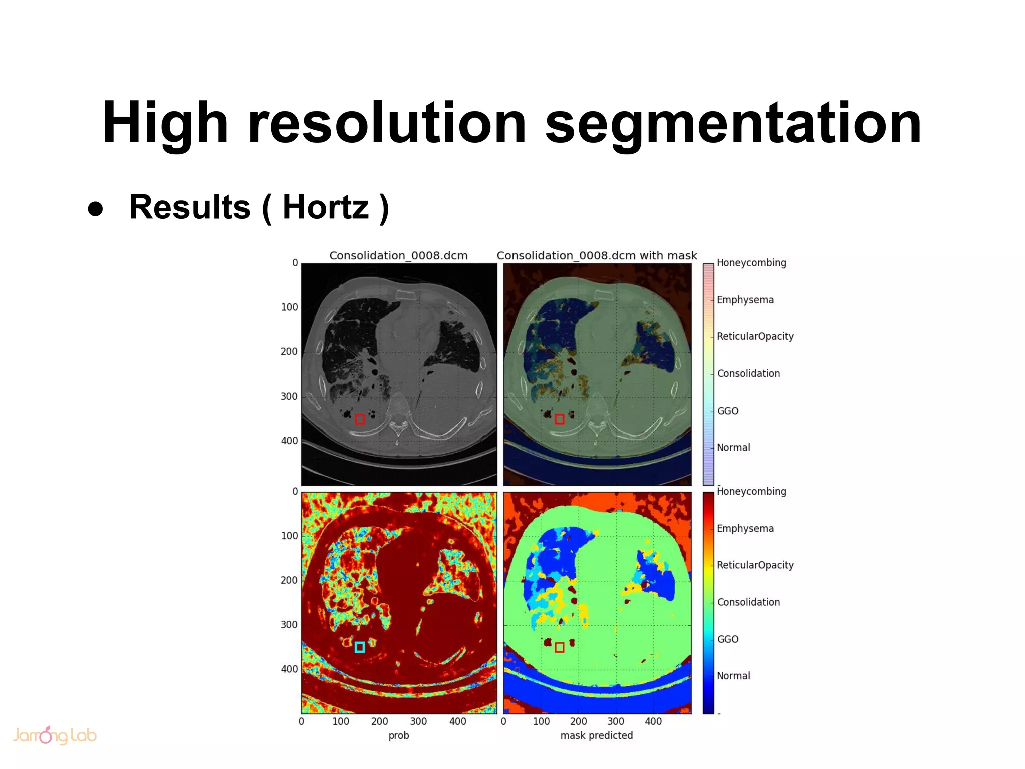 High resolution segmentation
● Results ( Hortz )
 