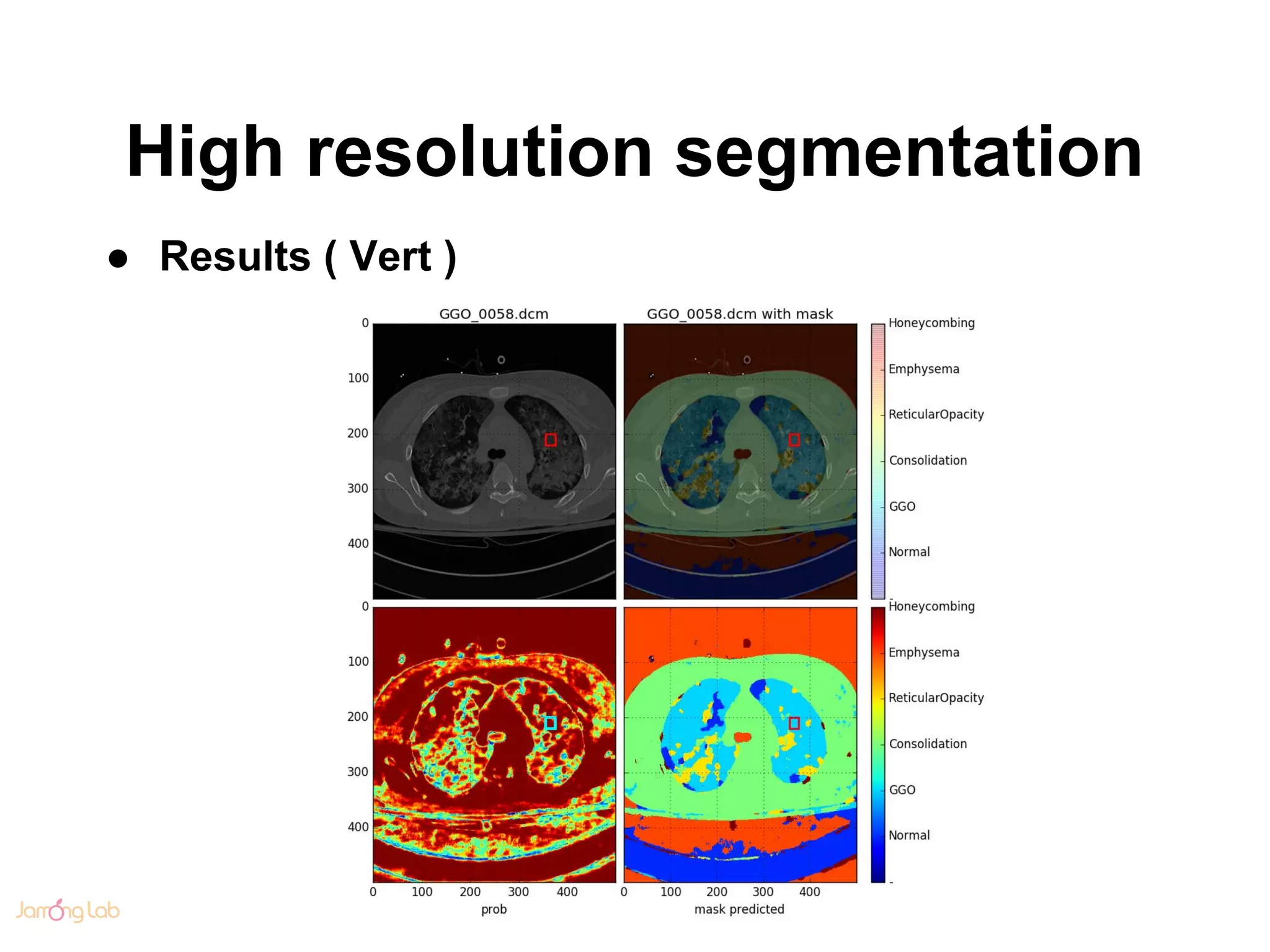 High resolution segmentation
● Results ( Vert )
 
