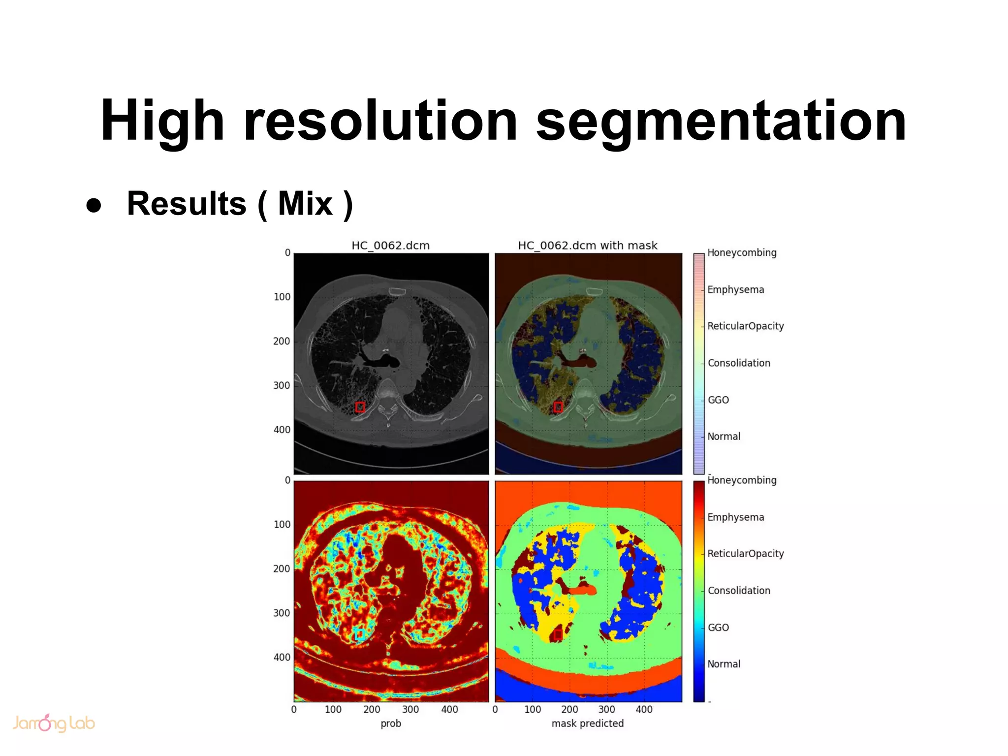 High resolution segmentation
● Results ( Mix )
 