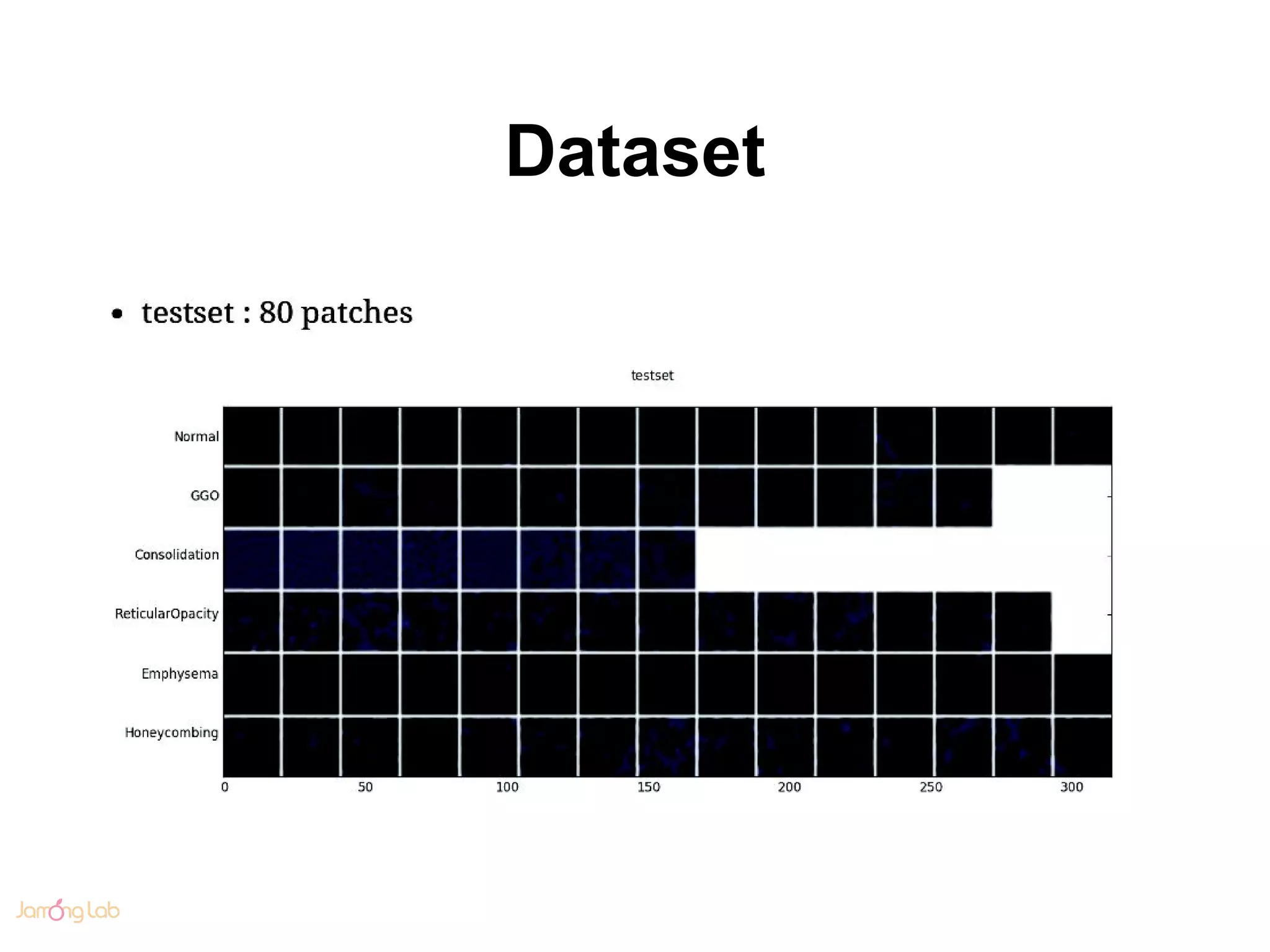 Dataset
 