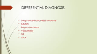 Antiphospholipid Antibody Syndrome : Case Presentation and Management ...