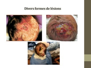 Diversformesdelésions
 