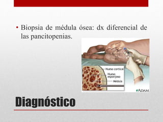 • Biopsia de médula ósea: dx diferencial de 
las pancitopenias. 
Diagnóstico 
 