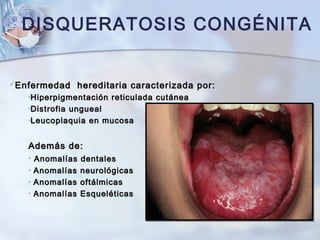 Enfermedad hereditaria caracterizada por:Enfermedad hereditaria caracterizada por:
•Hiperpigmentación reticulada cutáneaHiperpigmentación reticulada cutánea
•Distrofia unguealDistrofia ungueal
•Leucoplaquia en mucosaLeucoplaquia en mucosa
Además de:Además de:
• Anomalías dentalesAnomalías dentales
• Anomalías neurológicasAnomalías neurológicas
• Anomalías oftálmicasAnomalías oftálmicas
• Anomalías EsqueléticasAnomalías Esqueléticas
DISQUERATOSIS CONGÉNITA
 