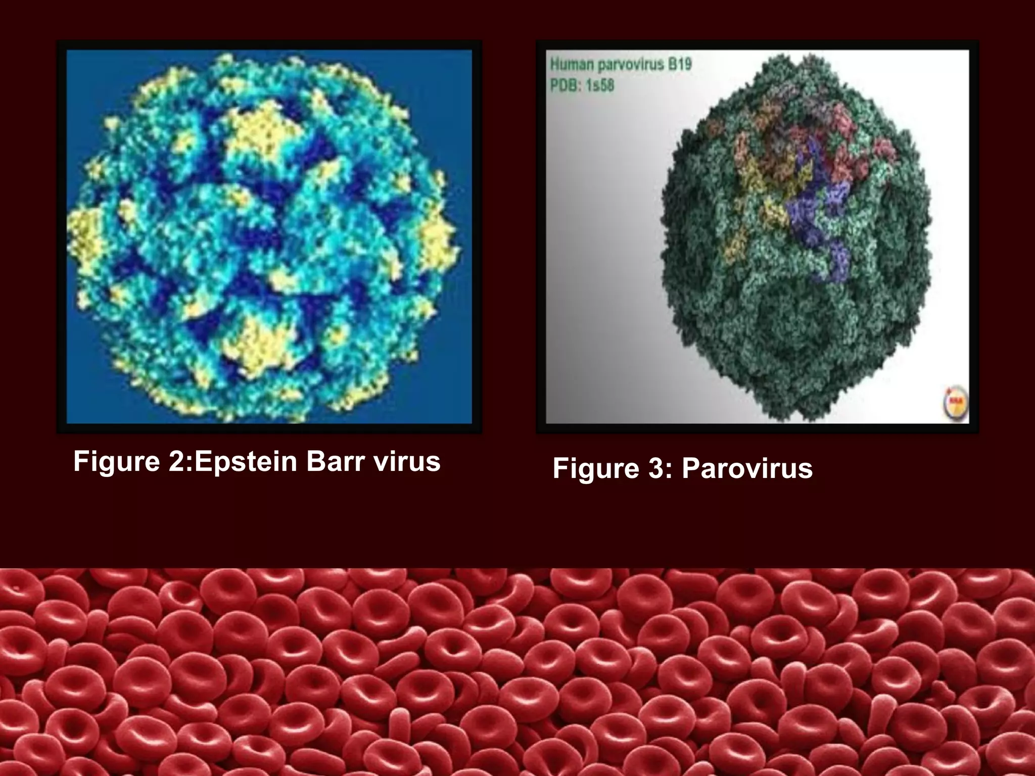 Figure 2:Epstein Barr virus Figure 3: Parovirus
 