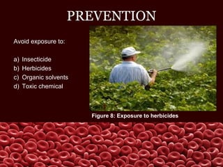 PREVENTION
Avoid exposure to:
a) Insecticide
b) Herbicides
c) Organic solvents
d) Toxic chemical
Figure 8: Exposure to herbicides
 
