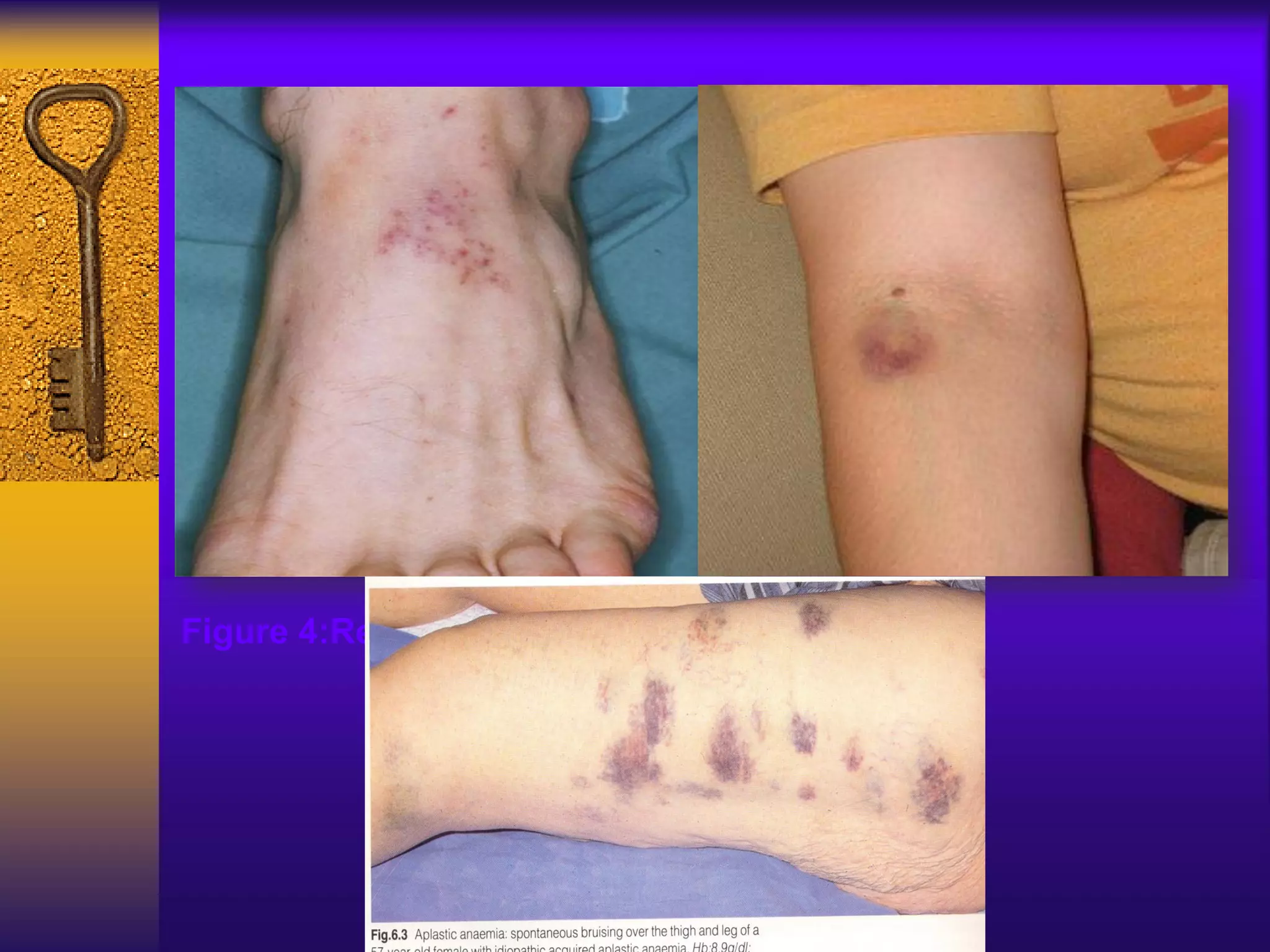 Figure 4:Red spots Figure 5:Bruise
 