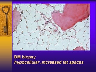 BM biopsy
hypocellular ,increased fat spaces
 