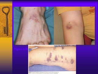 Figure 4:Red spots Figure 5:Bruise
 