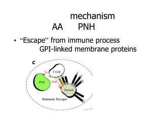 mechanism
           AA  PNH
• “Escape” from immune process
        GPI-linked membrane proteins
 