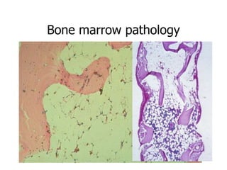Bone marrow pathology
 