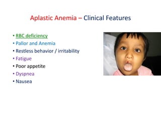 Aplastic Anemia – Clinical Features
• RBC deficiency
• Pallor and Anemia
• Restless behavior / irritability
• Fatigue
• Poor appetite
• Dyspnea
• Nausea
 