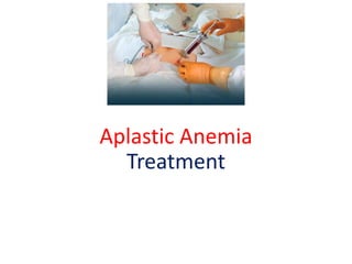 Aplastic Anemia
Treatment
 