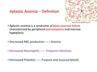 Aplastic Anemia – Definition
• Aplastic anemia is a syndrome of bone-marrow failure
characterized by peripheral pancytopenia and marrow
hypoplasia
• Decreased RBC production ----- Anemia
• Decreased Neutrophils ----- Frequent infections
• Decreased Platelets ----- Purpura and mucosal bleeds
 