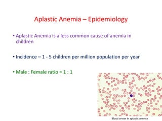 Aplastic Anemia – Epidemiology
• Aplastic Anemia is a less common cause of anemia in
children
• Incidence – 1 - 5 children per million population per year
• Male : Female ratio = 1 : 1
 