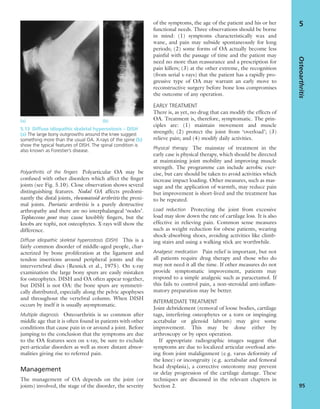Polyarthritis of the ﬁngers Polyarticular OA may be
confused with other disorders which affect the ﬁnger
joints (see Fig. 5.10). Close observation shows several
distinguishing features. Nodal OA affects predomi-
nantly the distal joints, rheumatoid arthritis the proxi-
mal joints. Psoriatic arthritis is a purely destructive
arthropathy and there are no interphalangeal ‘nodes’.
Tophaceous gout may cause knobbly ﬁngers, but the
knobs are tophi, not osteophytes. X-rays will show the
difference.
Diffuse idiopathic skeletal hyperostosis (DISH) This is a
fairly common disorder of middle-aged people, char-
acterized by bone proliferation at the ligament and
tendon insertions around peripheral joints and the
intervertebral discs (Resnick et al., 1975). On x-ray
examination the large bony spurs are easily mistaken
for osteophytes. DISH and OA often appear together,
but DISH is not OA: the bone spurs are symmetri-
cally distributed, especially along the pelvic apophyses
and throughout the vertebral column. When DISH
occurs by itself it is usually asymptomatic.
Multiple diagnosis Osteoarthritis is so common after
middle age that it is often found in patients with other
conditions that cause pain in or around a joint. Before
jumping to the conclusion that the symptoms are due
to the OA features seen on x-ray, be sure to exclude
peri-articular disorders as well as more distant abnor-
malities giving rise to referred pain.
Management
The management of OA depends on the joint (or
joints) involved, the stage of the disorder, the severity
of the symptoms, the age of the patient and his or her
functional needs. Three observations should be borne
in mind: (1) symptoms characteristically wax and
wane, and pain may subside spontaneously for long
periods; (2) some forms of OA actually become less
painful with the passage of time and the patient may
need no more than reassurance and a prescription for
pain killers; (3) at the other extreme, the recognition
(from serial x-rays) that the patient has a rapidly pro-
gressive type of OA may warrant an early move to
reconstructive surgery before bone loss compromises
the outcome of any operation.
EARLY TREATMENT
There is, as yet, no drug that can modify the effects of
OA. Treatment is, therefore, symptomatic. The prin-
ciples are: (1) maintain movement and muscle
strength; (2) protect the joint from ‘overload’; (3)
relieve pain; and (4) modify daily activities.
Physical therapy The mainstay of treatment in the
early case is physical therapy, which should be directed
at maintaining joint mobility and improving muscle
strength. The programme can include aerobic exer-
cise, but care should be taken to avoid activities which
increase impact loading. Other measures, such as mas-
sage and the application of warmth, may reduce pain
but improvement is short-lived and the treatment has
to be repeated.
Load reduction Protecting the joint from excessive
load may slow down the rate of cartilage loss. It is also
effective in relieving pain. Common sense measures
such as weight reduction for obese patients, wearing
shock-absorbing shoes, avoiding activities like climb-
ing stairs and using a walking stick are worthwhile.
Analgesic medication Pain relief is important, but not
all patients require drug therapy and those who do
may not need it all the time. If other measures do not
provide symptomatic improvement, patients may
respond to a simple analgesic such as paracetamol. If
this fails to control pain, a non-steroidal anti-inﬂam-
matory preparation may be better.
INTERMEDIATE TREATMENT
Joint debridement (removal of loose bodies, cartilage
tags, interfering osteophytes or a torn or impinging
acetabular or glenoid labrum) may give some
improvement. This may be done either by
arthroscopy or by open operation.
If appropriate radiographic images suggest that
symptoms are due to localized articular overload aris-
ing from joint malalignment (e.g. varus deformity of
the knee) or incongruity (e.g. acetabular and femoral
head dysplasia), a corrective osteotomy may prevent
or delay progression of the cartilage damage. These
techniques are discussed in the relevant chapters in
Section 2.
Osteoarthritis
95
5
(a) (b)
5.13 Diffuse idiopathic skeletal hyperostosis – DISH
(a) The large bony outgrowths around the knee suggest
something more than the usual OA. X-rays of the spine (b)
show the typical features of DISH. The spinal condition is
also known as Forestier’s disease.
 