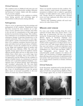 Clinical features
The condition starts in childhood with joint pain and
progressive signs of polyarticular swelling, deformity
and shortness of stature. Adults with this condition
may be severely crippled.
X-rays show distortion of the epiphyses in tubular
bones during growth, and increasing signs of
osteoarthritis in affected joints during adult life.
Pathogenesis
There is, as yet, no agreement about the aetiology and
pathogenesis of this condition. Hypothetical causes
that have received the most attention are (a) deﬁ-
ciency of trace elements such as selenium and iodine
in the soil and (b) contamination of the staple grain
product by mycotoxins during storage. This combina-
tion could lead to an accumulation of free radicals and
subsequent damage to growing chondrocytes in the
exposed community. There are, however, some argu-
ments against a purely environmental causation: ﬁrst,
there is no consistent correlation between local sele-
nium and iodine levels and the prevalence of Kashin–
Beck disease; second, the condition may be common
in one village and completely absent in another only
30–50 miles away (Allender, 1994). The early radi-
ographic changes appear only in the epiphyses and the
adjacent growth plates and not in other parts of the
tubular bones which must, at an earlier stage, have
consisted largely of cartilage. This, as well as the clin-
ical appearances and the tendency for the condition to
appear in familial clusters, are reminiscent of a genetic
disorder such as spondylo-epiphyseal dysplasia, a rec-
ognized cause of stunted growth, bone deformities
and ‘secondary’ polyarticular OA. The most likely
explanation for this endemic disorder is that it is either
an expression of a straightforward genetic defect caus-
ing a type of chondrodysplasia or that the genetic
defect causes an increased susceptibility to the toxic
effects of certain trace element deﬁciencies.
Treatment
There is no speciﬁc treatment for this condition. Pre-
ventive measures consist mainly of selenium supple-
mentation in children’s diet or added to agricultural
fertilizer. In iodine-deﬁcient areas, iodine is given as
well. Dosage should be monitored since selenium
excess can cause unpleasant side effects and, in some
cases, severe illness.
Patients with established arthritis will need treat-
ment as for other forms of OA.
MSELENI JOINT DISEASE
For many years visitors travelling along the eastern
seaboard of South Africa have known about a crip-
pling type of polyarticular OA that was common
among the Tsonga people living around the Mseleni
Mission Station in Northern Zululand (now
Kwazulu). The ﬁrst report in the medical literature
appeared in 1970 (Wittman and Fellingham, 1970).
Further studies suggested an overall prevalence rate of
at least 5 per cent, with women affected more often
than men and relatives of affected individuals much
more commonly than relatives of unaffected people
(Fellingham et al., 1973; Yach and Botha, 1985). A
later radiographic survey showed that the
polyarthropathy actually comprises two distinct dis-
orders: one with features of multiple epiphyseal dys-
plasia affecting males and females in equal proportions
and another with typical features of protrusio acetab-
uli occurring almost exclusively in females (Solomon
et al., 1986).
Clinical features
In the ﬁrst group, symptoms such as joint discomfort,
slight deformity and stunting of growth start to
appear in both boys and girls during childhood. When
x-ray changes appear they are those of symmetrically
Osteoarthritis
97
5
(a) (b)
5.15 Endemic osteoarthritis – Mseleni disease X-rays showing the two forms of osteoarthritis endemic in the African
population of eastern Kwazulu: (a) generalized epiphyseal dysplasia and (b) bilateral protrusio acetabuli.
 