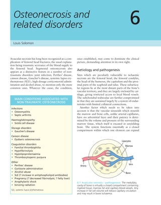 Avascular necrosis has long been recognized as a com-
plication of femoral head fractures, the usual explana-
tion being traumatic severance of the blood supply to
the femoral head. Segmental osteonecrosis also
appears as a distinctive feature in a number of non-
traumatic disorders: joint infection, Perthes’ disease,
caisson disease, Gaucher’s disease, systemic lupus ery-
thematosus (SLE), high-dosage corticosteroid admin-
istration and alcohol abuse, to mention only the more
common ones. Whatever the cause, the condition,
once established, may come to dominate the clinical
picture, demanding attention in its own right.
Aetiology and pathogenesis
Sites which are peculiarly vulnerable to ischaemic
necrosis are the femoral head, the femoral condyles,
the head of the humerus, the capitulum and the prox-
imal parts of the scaphoid and talus. These subarticu-
lar regions lie at the most distant parts of the bone’s
vascular territory, and they are largely enclosed by car-
tilage, giving restricted access to local blood vessels.
The subchondral trabeculae are further compromised
in that they are sustained largely by a system of endar-
terioles with limited collateral connections.
Another factor which needs to be taken into
account is that the vascular sinusoids which nourish
the marrow and bone cells, unlike arterial capillaries,
have no adventitial layer and their patency is deter-
mined by the volume and pressure of the surrounding
marrow tissue, which itself is encased in unyielding
bone. The system functions essentially as a closed
compartment within which one element can expand
Osteonecrosis and
related disorders 6
MAIN CONDITIONS ASSOCIATED WITH
NON-TRAUMATIC OSTEONECROSIS
Infections
• Osteomyelitis
• Septic arthritis
Haemoglobinopathy
• Sickle cell disease
Storage disorders
• Gaucher’s disease
Caisson disease
• Dysbaric osteonecrosis
Coagulation disorders
• Familial thrombophilia
• Hypoﬁbrinolysis
• Hypolipoproteinaemia
• Thrombocytopenic purpura
Other
• Perthes’ disease
• Cortisone administration
• Alcohol abuse
• SLE (? increase in antiphospholipid antibodies)
• Pregnancy (? decreased ﬁbrinolysis; ? fatty liver)
• Anaphylactic shock
• Ionizing radiation
SLE, systemic lupus erythematosus.
6.1 Avascular necrosis – pathogenesis The medullary
cavity of bone is virtually a closed compartment containing
myeloid tissue, marrow fat and capillary blood vessels. Any
increase in fat cell volume will reduce capillary circulation
and may result in bone ischaemia.
Louis Solomon
 