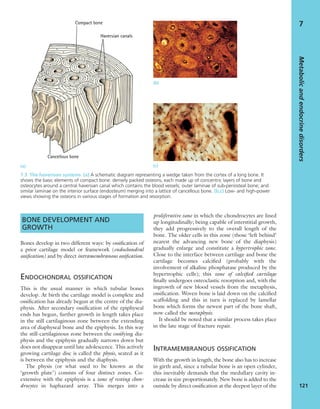 BONE DEVELOPMENT AND
GROWTH
Bones develop in two different ways: by ossiﬁcation of
a prior cartilage model or framework (endochondral
ossiﬁcation) and by direct intramembranous ossiﬁcation.
ENDOCHONDRAL OSSIFICATION
This is the usual manner in which tubular bones
develop. At birth the cartilage model is complete and
ossiﬁcation has already begun at the centre of the dia-
physis. After secondary ossiﬁcation of the epiphyseal
ends has begun, further growth in length takes place
in the still cartilaginous zone between the extending
area of diaphyseal bone and the epiphysis. In this way
the still-cartilaginous zone between the ossifying dia-
physis and the epiphysis gradually narrows down but
does not disappear until late adolescence. This actively
growing cartilage disc is called the physis, seated as it
is between the epiphysis and the diaphysis.
The physis (or what used to be known as the
‘growth plate’) consists of four distinct zones. Co-
extensive with the epiphysis is a zone of resting chon-
drocytes in haphazard array. This merges into a
proliferative zone in which the chondrocytes are lined
up longitudinally; being capable of interstitial growth,
they add progressively to the overall length of the
bone. The older cells in this zone (those ‘left behind’
nearest the advancing new bone of the diaphysis)
gradually enlarge and constitute a hypertrophic zone.
Close to the interface between cartilage and bone the
cartilage becomes calciﬁed (probably with the
involvement of alkaline phosphatase produced by the
hypertrophic cells); this zone of calciﬁed cartilage
ﬁnally undergoes osteoclastic resorption and, with the
ingrowth of new blood vessels from the metaphysis,
ossiﬁcation. Woven bone is laid down on the calciﬁed
scaffolding and this in turn is replaced by lamellar
bone which forms the newest part of the bone shaft,
now called the metaphysis.
It should be noted that a similar process takes place
in the late stage of fracture repair.
INTRAMEMBRANOUS OSSIFICATION
With the growth in length, the bone also has to increase
in girth and, since a tubular bone is an open cylinder,
this inevitably demands that the medullary cavity in-
crease in size proportionately. New bone is added to the
outside by direct ossiﬁcation at the deepest layer of the
Metabolicandendocrinedisorders
121
7
7.3 The haversian systems (a) A schematic diagram representing a wedge taken from the cortex of a long bone. It
shows the basic elements of compact bone: densely packed osteons, each made up of concentric layers of bone and
osteocytes around a central haversian canal which contains the blood vessels; outer laminae of sub-periosteal bone; and
similar laminae on the interior surface (endosteum) merging into a lattice of cancellous bone. (b,c) Low- and high-power
views showing the osteons in various stages of formation and resorption.
(a)
(b)
(c)
 