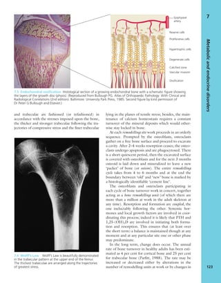 Epiphyseal
artery
Reserve cells
Proliferative cells
Hypertrophic cells
Degenerate cells
Calcified zone
Vascular invasion
Ossification
and trabeculae are fashioned (or refashioned) in
accordance with the stresses imposed upon the bone,
the thicker and stronger trabeculae following the tra-
jectories of compressive stress and the ﬁner trabeculae
lying in the planes of tensile stress; besides, the main-
tenance of calcium homeostasis requires a constant
turnover of the mineral deposits which would other-
wise stay locked in bone.
At each remodelling site work proceeds in an orderly
sequence. Prompted by the osteoblasts, osteoclasts
gather on a free bone surface and proceed to excavate
a cavity. After 2–4 weeks resorption ceases; the osteo-
clasts undergo apoptosis and are phagocytosed. There
is a short quiescent period, then the excavated surface
is covered with osteoblasts and for the next 3 months
osteoid is laid down and mineralized to leave a new
‘packet’ of bone (or osteon). The entire remodelling
cycle takes from 4 to 6 months and at the end the
boundary between ‘old’ and ‘new’ bone is marked by
a histologically identiﬁable ‘cement line’.
The osteoblasts and osteoclasts participating in
each cycle of bone turnover work in concert, together
acting as a bone remodelling unit (of which there are
more than a million at work in the adult skeleton at
any time). Resorption and formation are coupled, the
one ineluctably following the other. Systemic hor-
mones and local growth factors are involved in coor-
dinating this process; indeed it is likely that PTH and
1,25-(OH)2D are involved in initiating both forma-
tion and resorption. This ensures that (at least over
the short term) a balance is maintained though at any
moment and at any particular site one or other phase
may predominate.
In the long term, change does occur. The annual
rate of bone turnover in healthy adults has been esti-
mated as 4 per cent for cortical bone and 25 per cent
for trabecular bone (Parﬁtt, 1988). The rate may be
increased or decreased either by alterations in the
number of remodelling units at work or by changes in
Metabolicandendocrinedisorders
123
7
7.6 Wolff’s Law Wolff’s Law is beautifully demonstrated
in the trabecular pattern at the upper end of the femur.
The thickest trabeculae are arranged along the trajectories
of greatest stress.
7.5 Endochondral ossiﬁcation Histological section of a growing endochondral bone with a schematic ﬁgure showing
the layers of the growth disc (physis). (Reproduced from Bullough PG. Atlas of Orthopaedic Pathology: With Clinical and
Radiological Correlations (2nd edition). Baltimore: University Park Press, 1985. Second ﬁgure by kind permission of
Dr Peter G Bullough and Elsevier.)
 