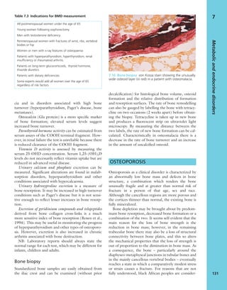 cia and in disorders associated with high bone
turnover (hyperparathyroidism, Paget’s disease, bone
metastases).
Osteocalcin (Gla protein) is a more speciﬁc marker
of bone formation; elevated serum levels suggest
increased bone turnover.
Parathyroid hormone activity can be estimated from
serum assays of the COOH terminal fragment. How-
ever, in renal failure the test is unreliable because there
is reduced clearance of the COOH fragment.
Vitamin D activity is assessed by measuring the
serum 25-OHD concentration. Serum 1,25-(OH)2D
levels do not necessarily reﬂect vitamin uptake but are
reduced in advanced renal disease.
Urinary calcium and phosphate excretion can be
measured. Signiﬁcant alterations are found in malab-
sorption disorders, hyperparathyroidism and other
conditions associated with hypercalcaemia.
Urinary hydroxyproline excretion is a measure of
bone resorption. It may be increased in high-turnover
conditions such as Paget’s disease but it is not sensi-
tive enough to reﬂect lesser increases in bone resorp-
tion.
Excretion of pyridinium compounds and telopeptides
derived from bone collagen cross-links is a much
more sensitive index of bone resorption (Rosen et al.,
1994). This may be useful in monitoring the progress
of hyperparathyroidism and other types of osteoporo-
sis. However, excretion is also increased in chronic
arthritis associated with bone destruction.
NB: Laboratory reports should always state the
normal range for each test, which may be different for
infants, children and adults.
Bone biopsy
Standardized bone samples are easily obtained from
the iliac crest and can be examined (without prior
decalciﬁcation) for histological bone volume, osteoid
formation and the relative distribution of formation
and resorption surfaces. The rate of bone remodelling
can also be gauged by labelling the bone with tetracy-
cline on two occasions (2 weeks apart) before obtain-
ing the biopsy. Tetracycline is taken up in new bone
and produces a ﬂuorescent strip on ultraviolet light
microscopy. By measuring the distance between the
two labels, the rate of new bone formation can be cal-
culated. Characteristically in osteomalacia there is a
decrease in the rate of bone turnover and an increase
in the amount of uncalciﬁed osteoid.
OSTEOPOROSIS
Osteoporosis as a clinical disorder is characterized by
an abnormally low bone mass and defects in bone
structure, a combination which renders the bone
unusually fragile and at greater than normal risk of
fracture in a person of that age, sex and race.
Although the cancellous regions are more porous and
the cortices thinner than normal, the existing bone is
fully mineralized.
Bone depletion may be brought about by predom-
inant bone resorption, decreased bone formation or a
combination of the two. It seems self-evident that the
main reason for the loss of bone strength is the
reduction in bone mass; however, in the remaining
trabecular bone there may also be a loss of structural
connectivity between bone plates, and this so alters
the mechanical properties that the loss of strength is
out of proportion to the diminution in bone mass. As
a consequence, the bone – particularly around the
diaphyseo-metaphyseal junctions in tubular bones and
in the mainly cancellous vertebral bodies – eventually
reaches a state in which a comparatively modest stress
or strain causes a fracture. For reasons that are not
fully understood, black African peoples are consider-
Metabolicandendocrinedisorders
131
7Table 7.3 Indications for BMD measurement
All postmenopausal women under the age of 65
Young women following oophorectomy
Men with testosterone deﬁciency
Perimenopausal women with fractures of wrist, ribs, vertebral
bodies or hip
Women or men with x-ray features of osteopaenia
Patients with hyperparathyroidism, hyperthyroidism, renal
insufﬁciency or rheumatoid arthritis
Patients on long-term glucocorticoids, thyroid hormone,
thiazide diuretics
Patients with dietary deﬁciencies
Some experts would add all women over the age of 65
regardless of risk factors
7.10 Bone biopsy von Kossa stain showing the unusually
wide osteoid layer (in red) in a patient with osteomalacia.
 