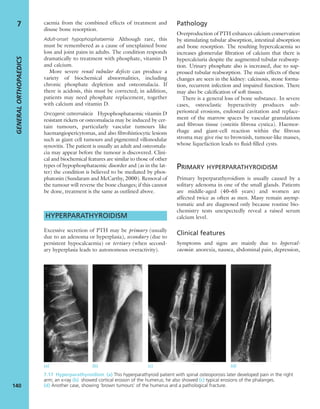 caemia from the combined effects of treatment and
disuse bone resorption.
Adult-onset hypophosphataemia Although rare, this
must be remembered as a cause of unexplained bone
loss and joint pains in adults. The condition responds
dramatically to treatment with phosphate, vitamin D
and calcium.
More severe renal tubular defects can produce a
variety of biochemical abnormalities, including
chronic phosphate depletion and osteomalacia. If
there is acidosis, this must be corrected; in addition,
patients may need phosphate replacement, together
with calcium and vitamin D.
Oncogenic osteomalacia Hypophosphataemic vitamin D
resistant rickets or osteomalacia may be induced by cer-
tain tumours, particularly vascular tumours like
haemangiopericytomas, and also ﬁbrohistiocytic lesions
such as giant cell tumours and pigmented villonodular
synovitis. The patient is usually an adult and osteomala-
cia may appear before the tumour is discovered. Clini-
cal and biochemical features are similar to those of other
types of hypophosphataemic disorder and (as in the lat-
ter) the condition is believed to be mediated by phos-
phatonin (Sundaram and McCarthy, 2000). Removal of
the tumour will reverse the bone changes; if this cannot
be done, treatment is the same as outlined above.
HYPERPARATHYROIDISM
Excessive secretion of PTH may be primary (usually
due to an adenoma or hyperplasia), secondary (due to
persistent hypocalcaemia) or tertiary (when second-
ary hyperplasia leads to autonomous overactivity).
Pathology
Overproduction of PTH enhances calcium conservation
by stimulating tubular absorption, intestinal absorption
and bone resorption. The resulting hypercalcaemia so
increases glomerular ﬁltration of calcium that there is
hypercalciuria despite the augmented tubular reabsorp-
tion. Urinary phosphate also is increased, due to sup-
pressed tubular reabsorption. The main effects of these
changes are seen in the kidney: calcinosis, stone forma-
tion, recurrent infection and impaired function. There
may also be calciﬁcation of soft tissues.
There is a general loss of bone substance. In severe
cases, osteoclastic hyperactivity produces sub-
periosteal erosions, endosteal cavitation and replace-
ment of the marrow spaces by vascular granulations
and ﬁbrous tissue (osteitis ﬁbrosa cystica). Haemor-
rhage and giant-cell reaction within the ﬁbrous
stroma may give rise to brownish, tumour-like masses,
whose liquefaction leads to ﬂuid-ﬁlled cysts.
PRIMARY HYPERPARATHYROIDISM
Primary hyperparathyroidism is usually caused by a
solitary adenoma in one of the small glands. Patients
are middle-aged (40–65 years) and women are
affected twice as often as men. Many remain asymp-
tomatic and are diagnosed only because routine bio-
chemistry tests unexpectedly reveal a raised serum
calcium level.
Clinical features
Symptoms and signs are mainly due to hypercal-
caemia: anorexia, nausea, abdominal pain, depression,
GENERALORTHOPAEDICS
140
7
7.17 Hyperparathyroidism (a) This hyperparathyroid patient with spinal osteoporosis later developed pain in the right
arm; an x-ray (b) showed cortical erosion of the humerus; he also showed (c) typical erosions of the phalanges.
(d) Another case, showing ‘brown tumours’ of the humerus and a pathological fracture.
(a) (b) (c) (d)
 