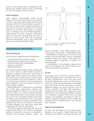 embryos can be detected prior to implantation, thus
allowing only ‘healthy’ embryos (as far as technology
can tell) to be implanted into the mother.
Fetal imaging
High resolution ultrasonography should provide
images of all the long bones and joint movements by
11 weeks of gestation. Bone lengths increase linearly
with time and by 18–23 weeks all three segments of
each limb are clearly visible; a single measurement of
one bone can be used to estimate growth. A femoral
length that is normal for the fetal age is very signiﬁ-
cant in excluding many of the skeletal dysplasias or
malformations; even with mesomelic abnormalities
where the lower leg is most affected, the femur is
likely to be short. By the 18th week of pregnancy
anatomical abnormalities such as open neural tube
defects and short limbs should be visible.
DIAGNOSIS IN CHILDHOOD
Clinical features
Tell-tale features suggesting skeletal dysplasia are:
• retarded growth and shortness of stature
• disproportionate length of trunk and limbs
• localized malformations (dysmorphism)
• soft-tissue contractures
• childhood deformity.
All the skeletal dysplasias affect growth, although this
may not be obvious at birth. Children should be
measured at regular intervals and a record kept of
height, length of lower segment (top of pubic symph-
ysis to heel), upper segment (pubis to cranium), span,
head circumference and chest circumference. Failure
to reach the expected height for the local population
group should be noted, and marked shortness of
stature is highly suspicious.
Bodily proportion is as important as overall height.
The normal upper segment:lower segment ratio
changes gradually from about 1.5:1 at the end of the
ﬁrst year to about 1:1 at puberty. Shortness of stature
with normal proportions is not necessarily abnormal,
but it is also seen in endocrine disorders which affect
the different parts of the skeleton more or less equally
(e.g. hypopituitarism). By contrast, small stature with
disproportionate shortness of the limbs is characteristic
of skeletal dysplasia, the long bones being more
markedly affected than the axial skeleton.
The different segments of the limbs also may be dis-
proportionately affected. The subtleties of dysplastic
growth are reﬂected in terms such as rhizomelia –
unusually short proximal segments (humeri and
femora), mesomelia – short middle segments (fore-
arms and legs) and acromelia – stubby hands and feet.
Dysmorphism (a misshapen part of the body) is most
obvious in the face and hands. There is a remarkable
consistency about these changes, which makes for a
disturbing similarity of appearance in members of a
particular group.
Local deformities – such as kyphosis, valgus or varus
knees, bowed forearms and ulnar deviated wrists –
result from disturbed bone growth.
X-rays
The presence of any of the above features calls for a
limited radiographic survey: a posteroanterior view of
the chest, anteroposterior views of the pelvis, knees
and hands, additional views of one arm and one leg, a
lateral view of the thoracolumbar spine and standard
views of the skull. Fractures, bent bones, exostoses,
epiphyseal dysplasia and spinal deformities may be
obvious, especially in the older child. Sometimes a
complete survey is needed and it is important to note
which portion of the long bones (epiphysis, metaph-
ysis or diaphysis) is affected. With severe and varied
changes in the metaphyses, periosteal new bone for-
mation or epiphyseal separation, always consider the
possibility of non-accidental injuries – the ‘battered
baby’ syndrome.
Special investigations
In many cases the diagnosis can be made without
laboratory tests; however, routine blood and urine
analysis may be helpful in excluding metabolic and
Geneticdisorders,skeletaldysplasiasandmalformations
155
8
8.2 Normal proportions Upper segment = lower
segment. Total height = span.
 