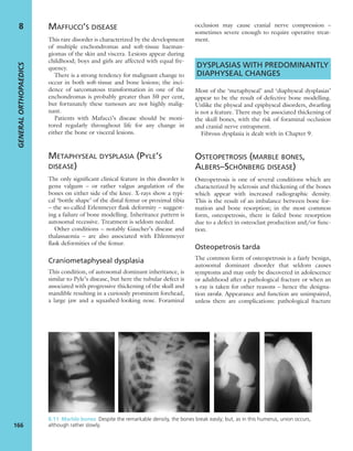 MAFFUCCI’S DISEASE
This rare disorder is characterized by the development
of multiple enchondromas and soft-tissue haeman-
giomas of the skin and viscera. Lesions appear during
childhood; boys and girls are affected with equal fre-
quency.
There is a strong tendency for malignant change to
occur in both soft-tissue and bone lesions; the inci-
dence of sarcomatous transformation in one of the
enchondromas is probably greater than 50 per cent,
but fortunately these tumours are not highly malig-
nant.
Patients with Mafucci’s disease should be moni-
tored regularly throughout life for any change in
either the bone or visceral lesions.
METAPHYSEAL DYSPLASIA (PYLE’S
DISEASE)
The only significant clinical feature in this disorder is
genu valgum – or rather valgus angulation of the
bones on either side of the knee. X-rays show a typi-
cal ‘bottle shape’ of the distal femur or proximal tibia
– the so-called Erlenmeyer flask deformity – suggest-
ing a failure of bone modelling. Inheritance pattern is
autosomal recessive. Treatment is seldom needed.
Other conditions – notably Gaucher’s disease and
thalassaemia – are also associated with Ehlenmeyer
ﬂask deformities of the femur.
Craniometaphyseal dysplasia
This condition, of autosomal dominant inheritance, is
similar to Pyle’s disease, but here the tubular defect is
associated with progressive thickening of the skull and
mandible resulting in a curiously prominent forehead,
a large jaw and a squashed-looking nose. Foraminal
occlusion may cause cranial nerve compression –
sometimes severe enough to require operative treat-
ment.
DYSPLASIAS WITH PREDOMINANTLY
DIAPHYSEAL CHANGES
Most of the ‘metaphyseal’ and ‘diaphyseal dysplasias’
appear to be the result of defective bone modelling.
Unlike the physeal and epiphyseal disorders, dwarﬁng
is not a feature. There may be associated thickening of
the skull bones, with the risk of foraminal occlusion
and cranial nerve entrapment.
Fibrous dysplasia is dealt with in Chapter 9.
OSTEOPETROSIS (MARBLE BONES,
ALBERS–SCHÖNBERG DISEASE)
Osteopetrosis is one of several conditions which are
characterized by sclerosis and thickening of the bones
which appear with increased radiographic density.
This is the result of an imbalance between bone for-
mation and bone resorption; in the most common
form, osteopetrosis, there is failed bone resorption
due to a defect in osteoclast production and/or func-
tion.
Osteopetrosis tarda
The common form of osteopetrosis is a fairly benign,
autosomal dominant disorder that seldom causes
symptoms and may only be discovered in adolescence
or adulthood after a pathological fracture or when an
x-ray is taken for other reasons – hence the designa-
tion tarda. Appearance and function are unimpaired,
unless there are complications: pathological fracture
GENERALORTHOPAEDICS
166
8
8.11 Marble bones Despite the remarkable density, the bones break easily; but, as in this humerus, union occurs,
although rather slowly.
 