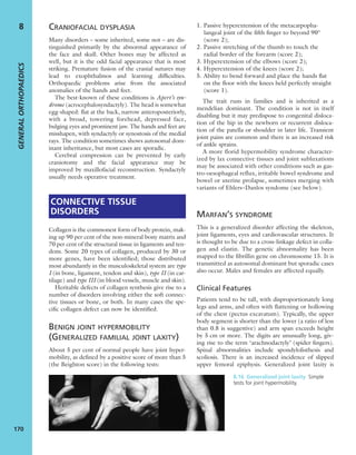 CRANIOFACIAL DYSPLASIA
Many disorders – some inherited, some not – are dis-
tinguished primarily by the abnormal appearance of
the face and skull. Other bones may be affected as
well, but it is the odd facial appearance that is most
striking. Premature fusion of the cranial sutures may
lead to exophthalmos and learning difﬁculties.
Orthopaedic problems arise from the associated
anomalies of the hands and feet.
The best-known of these conditions is Apert’s syn-
drome (acrocephalosyndactyly). The head is somewhat
egg-shaped: ﬂat at the back, narrow anteroposteriorly,
with a broad, towering forehead, depressed face,
bulging eyes and prominent jaw. The hands and feet are
misshapen, with syndactyly or synostosis of the medial
rays. The condition sometimes shows autosomal dom-
inant inheritance, but most cases are sporadic.
Cerebral compression can be prevented by early
craniotomy and the facial appearance may be
improved by maxillofacial reconstruction. Syndactyly
usually needs operative treatment.
CONNECTIVE TISSUE
DISORDERS
Collagen is the commonest form of body protein, mak-
ing up 90 per cent of the non-mineral bony matrix and
70 per cent of the structural tissue in ligaments and ten-
dons. Some 20 types of collagen, produced by 30 or
more genes, have been identiﬁed; those distributed
most abundantly in the musculoskeletal system are type
I (in bone, ligament, tendon and skin), type II (in car-
tilage) and type III (in blood vessels, muscle and skin).
Heritable defects of collagen synthesis give rise to a
number of disorders involving either the soft connec-
tive tissues or bone, or both. In many cases the spe-
ciﬁc collagen defect can now be identiﬁed.
BENIGN JOINT HYPERMOBILITY
(GENERALIZED FAMILIAL JOINT LAXITY)
About 5 per cent of normal people have joint hyper-
mobility, as deﬁned by a positive score of more than 5
(the Beighton score) in the following tests:
1. Passive hyperextension of the metacarpopha-
langeal joint of the ﬁfth ﬁnger to beyond 90°
(score 2);
2. Passive stretching of the thumb to touch the
radial border of the forearm (score 2);
3. Hyperextension of the elbows (score 2);
4. Hyperextension of the knees (score 2);
5. Ability to bend forward and place the hands ﬂat
on the ﬂoor with the knees held perfectly straight
(score 1).
The trait runs in families and is inherited as a
mendelian dominant. The condition is not in itself
disabling but it may predispose to congenital disloca-
tion of the hip in the newborn or recurrent disloca-
tion of the patella or shoulder in later life. Transient
joint pains are common and there is an increased risk
of ankle sprains.
A more florid hypermobility syndrome character-
ized by lax connective tissues and joint subluxations
may be associated with other conditions such as gas-
tro-oesophageal reflux, irritable bowel syndrome and
bowel or uterine prolapse, sometimes merging with
variants of Ehlers–Danlos syndome (see below).
MARFAN’S SYNDROME
This is a generalized disorder affecting the skeleton,
joint ligaments, eyes and cardiovascular structures. It
is thought to be due to a cross-linkage defect in colla-
gen and elastin. The genetic abnormality has been
mapped to the ﬁbrillin gene on chromosome 15. It is
transmitted as autosomal dominant but sporadic cases
also occur. Males and females are affected equally.
Clinical Features
Patients tend to be tall, with disproportionately long
legs and arms, and often with ﬂattening or hollowing
of the chest (pectus excavatum). Typically, the upper
body segment is shorter than the lower (a ratio of less
than 0.8 is suggestive) and arm span exceeds height
by 5 cm or more. The digits are unusually long, giv-
ing rise to the term ‘arachnodactyly’ (spider ﬁngers).
Spinal abnormalities include spondylolisthesis and
scoliosis. There is an increased incidence of slipped
upper femoral epiphysis. Generalized joint laxity is
GENERALORTHOPAEDICS
170
8
8.16 Generalized joint laxity Simple
tests for joint hypermobility.
 