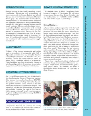 HOMOCYSTINURIA
This rare disorder is due to deﬁciency of the enzyme
cystathionine b-synthetase and accumulation of
homocysteine and methionine. Patients are tall and
thin and may develop features reminiscent of Marfan’s
disease (page 170). However, unlike Marfan’s disease,
homocystinuria is of autosomal recessive inheritance
and is associated with marked osteoporosis and learn-
ing difﬁculty. Joint laxity is unusual but there may be
muscle weakness. Thromboembolic disease is com-
mon and may be fatal. Homocysteine levels are raised
in the blood and urine. The enzyme deﬁciency may be
detected in ﬁbroblast cultures. Though rare, the con-
dition should be diagnosed because it can be treated:
about half the patients are ‘cured’ by pyridoxine (vit-
amin B6) administered from early childhood. Others
may be helped by a low methionine, cysteine-supple-
mented diet.
ALKAPTONURIA
Deﬁciency of the enzyme homogentisic acid oxidase
leads to accumulation of homogentisic acid, which is
deposited in connective tissue and excreted in the urine.
On standing the urine turns dark (hence the name, alka-
ptonuria); cartilage and other connective tissues are
stained grey – a condition referred to as ochronosis.
Clinical problems arise from degenerative changes in
articular cartilage with the development of osteoarthri-
tis, and from calciﬁcation of the intervertebral discs.
CONGENITAL HYPERURICAEMIA
The Lesch–Nyhan syndrome is a rare, X-linked reces-
sive disorder causing absence of the enzyme hypoxan-
thine-guanine phosphoribosyltransferase (HGPRT).
This enzyme controls a ‘salvage pathway’ in the com-
plex purine metabolic chain; absence of HGPRT
results in excessive uric acid formation and gout. The
young boys have learning difﬁculties and are prone to
self-mutilation (gnawing the ends of their ﬁngers).
Milder cases present simply as early-onset severe gout.
Diagnosis can be conﬁrmed by measuring HGPRT in
red cell preparations.
CHROMOSOME DISORDERS
Chromosome disorders are common but usually
result in fetal abortion. Of the non-lethal conditions,
several produce bone or joint abnormalities.
DOWN’S SYNDROME (TRISOMY 21)
This condition results, in 95 per cent of cases, from
having an extra copy of chromosome 21. It is much
more common than any of the skeletal dysplasias, with
an overall incidence of 1 per 800 live births – and 1 in
250 if the mother is over 37 years of age.
Clinical features
Affected infants can be recognized at birth: the head
is foreshortened and the eyes slant upwards, with
prominent epicanthic folds; the nose is ﬂattened, the
lips are parted and the tongue protrudes. There may
be abnormal palmar creases, clinodactyly and spread-
ing of the ﬁrst and second toes. The babies are unusu-
ally ﬂoppy (hypotonic) and skeletal development is
delayed. Children are short and, because of their char-
acteristic facial appearance, they tend to resemble each
other. They show varying degrees of learning difﬁ-
culty. Joint laxity may lead to sprains or subluxation
(e.g. of the patella). Plano-valgus feet are common
and some children develop developmental dysplasia of
the hip. Up to 50 per cent of these children – and par-
ticularly those more severely affected – will develop
idiopathic scoliosis. Despite these physical drawbacks,
functional performance is surprisingly good and over-
treatment must be resisted.
Adults have a signiﬁcant incidence of atlantoaxial
instability, though fortunately this seldom causes neu-
rological complications. Associated anomalies, partic-
ularly cardiac defects, are common, and there is
diminished resistance to infection. Life expectancy is
about 35 years.
Geneticdisorders,skeletaldysplasiasandmalformations
179
8
8.25 Down’s syndrome Head shape and facial features
in an eleven-month old child with Down’s syndrome.
 