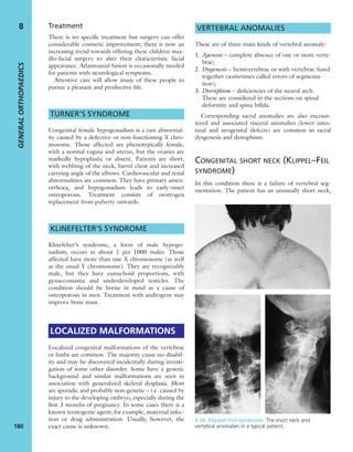 Treatment
There is no speciﬁc treatment but surgery can offer
considerable cosmetic improvement; there is now an
increasing trend towards offering these children max-
illo-facial surgery to alter their characteristic facial
appearance. Atlantoaxial fusion is occasionally needed
for patients with neurological symptoms.
Attentive care will allow many of these people to
pursue a pleasant and productive life.
TURNER’S SYNDROME
Congenital female hypogonadism is a rare abnormal-
ity caused by a defective or non-functioning X chro-
mosome. Those affected are phenotypically female,
with a normal vagina and uterus, but the ovaries are
markedly hypoplastic or absent. Patients are short,
with webbing of the neck, barrel chest and increased
carrying angle of the elbows. Cardiovascular and renal
abnormalities are common. They have primary amen-
orrhoea, and hypogonadism leads to early-onset
osteoporosis. Treatment consists of oestrogen
replacement from puberty onwards.
KLINEFELTER’S SYNDROME
Klinefelter’s syndrome, a form of male hypogo-
nadism, occurs in about 1 per 1000 males. Those
affected have more than one X chromosome (as well
as the usual Y chromosome). They are recognizably
male, but they have eunuchoid proportions, with
gynaecomastia and underdeveloped testicles. The
condition should be borne in mind as a cause of
osteoporosis in men. Treatment with androgens may
improve bone mass.
LOCALIZED MALFORMATIONS
Localized congenital malformations of the vertebrae
or limbs are common. The majority cause no disabil-
ity and may be discovered incidentally during investi-
gation of some other disorder. Some have a genetic
background and similar malformations are seen in
association with generalized skeletal dysplasia. Most
are sporadic and probably non-genetic – i.e. caused by
injury to the developing embryo, especially during the
ﬁrst 3 months of pregnancy. In some cases there is a
known teratogenic agent; for example, maternal infec-
tion or drug administration. Usually, however, the
exact cause is unknown.
VERTEBRAL ANOMALIES
These are of three main kinds of vertebral anomaly:
1. Agenesis – complete absence of one or more verte-
brae;
2. Dysgenesis – hemivertebrae or with vertebrae fused
together (sometimes called errors of segmenta-
tion);
3. Dysraphism – deﬁciencies of the neural arch.
These are considered in the sections on spinal
deformity and spina biﬁda.
Corresponding sacral anomalies are also encoun-
tered and associated visceral anomalies (lower intes-
tinal and urogenital defects) are common in sacral
dysgenesis and dysraphism.
CONGENITAL SHORT NECK (KLIPPEL–FEIL
SYNDROME)
In this condition there is a failure of vertebral seg-
mentation. The patient has an unusually short neck,
GENERALORTHOPAEDICS
180
8
8.26 Klippel–Feil syndrome The short neck and
vertebral anomalies in a typical patient.
 