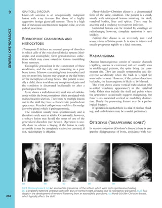 GIANT-CELL SARCOMA
Giant-cell sarcoma is an unequivocally malignant
lesion with x-ray features like those of a highly
aggressive benign giant-cell tumour. There is a high
risk of metastasis and treatment requires wide, or even
radical, resection.
EOSINOPHILIC GRANULOMA AND
HISTIOCYTOSIS
Histiocytosis-X deﬁnes an unusual group of disorders
in which cells of the reticuloendothelial system (histi-
ocytes and eosinophils) form granulomatous collec-
tions which may cause osteolytic lesions resembling
bone tumours.
Eosinophilic granuloma is the commonest of these
conditions, and the only one presenting as a pure
bone lesion. Marrow-containing bone is resorbed and
one or more lytic lesions may appear in the ﬂat bones
or the metaphyses of long bones. The patient is usu-
ally a child; there is seldom any complaint of pain and
the condition is discovered incidentally or after a
pathological fracture.
X-ray shows a well-demarcated oval area of radiolu-
cency within the bone; sometimes this is associated with
marked reactive sclerosis. There may be multiple lesions
and in the skull they have a characteristic punched-out
appearance. Vertebral collapse may result in a ﬂat wedge
(vertebra plana) which is pathognomonic.
The condition usually heals spontaneously and is
therefore rarely seen in adults. Occasionally, however,
a solitary lesion may herald the onset of one of the
generalized disorders (see below). Operation is usu-
ally done to obtain a biopsy; if the lesion is easily
accessible it may be completely excised or curetted; if
not, radiotherapy is effective.
Hand–Schüller–Christian disease is a disseminated
form of the same condition. The patient is a child,
usually with widespread lesions involving the skull,
vertebral bodies, liver and spleen. There may be
anaemia and a tendency to recurrent infection.
Individual lesions can be treated by curettage or
radiotherapy; however, complete remission is very
unlikely.
Letterer–Siwe disease is an extremely rare (and
severe) form of histiocytosis. It is seen in infants and
usually progresses rapidly to a fatal outcome.
HAEMANGIOMA
Osseous haemangiomas consist of vascular channels
(capillary, venous or cavernous) and are usually seen
in middle-aged patients, the spine being the com-
monest site. They are usually symptomless and dis-
covered accidentally when the back is x-rayed for
some other reason. However, if the patient does have
backache, the haemangioma is likely to be blamed.
The x-ray shows coarse vertical trabeculation (the
so-called ‘corduroy appearance’) in the vertebral
body. Other sites include the skull and pelvis where
the appearance occasionally suggests malignancy, but
there is no associated cortical or medullary destruc-
tion. Rarely the presenting feature may be a patho-
logical fracture.
If operation is needed there is a risk of profuse bleed-
ing, and embolization may be a useful preliminary.
OSTEOLYSIS (‘DISAPPEARING BONES’)
In massive osteolysis (Gorham’s disease) there is pro-
gressive disappearance of bone, associated with hae-
GENERALORTHOPAEDICS
204
9
(a) (b) (c) (d) (e)
9.21 Histiocytosis-X (a) An eosinophilic granuloma of the ischium which went on to spontaneous healing.
(b) Completely ﬂattened vertebral body with discs of normal height, probably due to eosinophilic granuloma. (c,d) Two
stages in the development of vertebral ﬂattening from an eosinophilic granuloma. (e) Hand–Schüller–Christian disease,
which typically affects the skull.
 