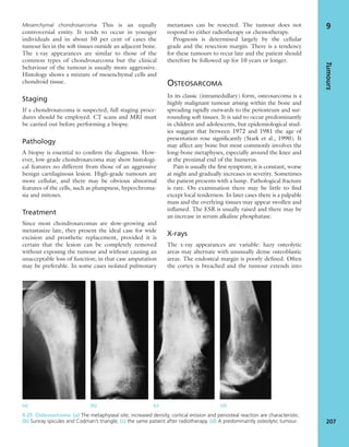 Mesenchymal chondrosarcoma This is an equally
controversial entity. It tends to occur in younger
individuals and in about 50 per cent of cases the
tumour lies in the soft tissues outside an adjacent bone.
The x-ray appearances are similar to those of the
common types of chondrosarcoma but the clinical
behaviour of the tumour is usually more aggressive.
Histology shows a mixture of mesenchymal cells and
chondroid tissue.
Staging
If a chondrosarcoma is suspected, full staging proce-
dures should be employed. CT scans and MRI must
be carried out before performing a biopsy.
Pathology
A biopsy is essential to conﬁrm the diagnosis. How-
ever, low-grade chondrosarcoma may show histologi-
cal features no different from those of an aggressive
benign cartilaginous lesion. High-grade tumours are
more cellular, and there may be obvious abnormal
features of the cells, such as plumpness, hyperchroma-
sia and mitoses.
Treatment
Since most chondrosarcomas are slow-growing and
metastasize late, they present the ideal case for wide
excision and prosthetic replacement, provided it is
certain that the lesion can be completely removed
without exposing the tumour and without causing an
unacceptable loss of function; in that case amputation
may be preferable. In some cases isolated pulmonary
metastases can be resected. The tumour does not
respond to either radiotherapy or chemotherapy.
Prognosis is determined largely by the cellular
grade and the resection margin. There is a tendency
for these tumours to recur late and the patient should
therefore be followed up for 10 years or longer.
OSTEOSARCOMA
In its classic (intramedullary) form, osteosarcoma is a
highly malignant tumour arising within the bone and
spreading rapidly outwards to the periosteum and sur-
rounding soft tissues. It is said to occur predominantly
in children and adolescents, but epidemiological stud-
ies suggest that between 1972 and 1981 the age of
presentation rose signiﬁcantly (Stark et al., 1990). It
may affect any bone but most commonly involves the
long-bone metaphyses, especially around the knee and
at the proximal end of the humerus.
Pain is usually the ﬁrst symptom; it is constant, worse
at night and gradually increases in severity. Sometimes
the patient presents with a lump. Pathological fracture
is rare. On examination there may be little to ﬁnd
except local tenderness. In later cases there is a palpable
mass and the overlying tissues may appear swollen and
inﬂamed. The ESR is usually raised and there may be
an increase in serum alkaline phosphatase.
X-rays
The x-ray appearances are variable: hazy osteolytic
areas may alternate with unusually dense osteoblastic
areas. The endosteal margin is poorly deﬁned. Often
the cortex is breached and the tumour extends into
Tumours
207
9
9.25 Osteosarcoma (a) The metaphyseal site; increased density, cortical erosion and periosteal reaction are characteristic.
(b) Sunray spicules and Codman’s triangle; (c) the same patient after radiotherapy. (d) A predominantly osteolytic tumour.
(a) (b) (c) (d)
 