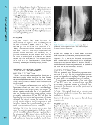 ried out. Depending on the site of the tumour, prepa-
rations would have been made to replace that segment
of bone with either a large bone graft or a custom-
made implant; in some cases an amputation may be
more appropriate.
The pathological specimen is examined to assess the
response to preoperative chemotherapy. If tumour
necrosis is marked (more than 90 per cent),
chemotherapy is continued for another 6–12 months;
if the response is poor, a different chemotherapeutic
regime is substituted.
Pulmonary metastases, especially if they are small
and peripherally situated, may be completely resected
with a wedge of lung tissue.
Outcome
Long-term survival after wide resection and
chemotherapy has improved from around 50 per cent
in 1980 (Rosen et al., 1982; Carter et al., 1991) to
over 60 per cent in recent years (Smeland et al.,
2004). Tumour-replacement implants usually func-
tion well. There is a fairly high complication rate
(mainly wound breakdown and infection) but, in
patients who survive, 10-year survival with mechani-
cal failure as the end point is 75 per cent and for fail-
ure for any cause is 58 per cent. The limb salvage rate
at 20 years is 84 per cent (Jeys et al., 2008) Aseptic
loosening is more prevalent in younger patients.
VARIANTS OF OSTEOSARCOMA
PAROSTEAL OSTEOSARCOMA
This is a low-grade sarcoma situated on the surface of
one of the tubular bones, usually at the distal femoral
or proximal tibial metaphysis. The patient is a young
adult who presents with a slowly enlarging mass near
the bone end.
X-ray shows a dense bony mass on the surface of the
bone or encircling it; the cortex is not eroded and usu-
ally a thin gap remains between cortex and tumour. The
picture is easily mistaken for that of a benign bone le-
sion and the diagnosis is often missed until the tumour
recurs after local excision. CT and MRI will show the
boundary between tumour and surrounding soft tissues.
Although the lesion is outside the bone, it does not
spread into the adjacent muscle compartment until
fairly late. Staging, therefore, often deﬁnes it as a low-
grade intracompartmental tumour (stage IA).
Pathology At biopsy the tumour appears as a hard
mass. On microscopic examination the lesion consists
of well-formed bone but without any regular trabecu-
lar arrangement. The spaces between trabeculae are
ﬁlled with cellular ﬁbroblastic tissue; a few atypical
cells and mitotic ﬁgures can usually be found. Occa-
sionally the tumour has a much more aggressive
appearance (dedifferentiated parosteal osteosarcoma).
Treatment For a low-grade parosteal osteosarcoma,
wide excision without adjuvant therapy is sufﬁcient to
ensure a recurrence rate below 10 per cent. Dediffer-
entiated parosteal osteosarcoma should be treated in
the same way as intramedullary sarcoma.
PERIOSTEAL OSTEOSARCOMA
This rare tumour is quite distinct from parosteal osteo-
sarcoma. It is more like an intramedullary osteosar-
coma, but situated on the surface of the bone. It occurs
in young adults and causes local pain and swelling.
X-ray shows a superﬁcial defect of the cortex, but
CT and MRI may reveal a larger soft-tissue mass. The
appearances sometimes suggest a periosteal chon-
droma and the diagnosis may not be certain until a
biopsy is performed.
Pathology Histologically this is a true osteosarcoma,
but characteristically the sections show a prominent
cartilaginous element.
Treatment Treatment is the same as that of classic
osteosarcoma.
PAGET’S SARCOMA
Paget’s disease affects about 2 per cent of western
Europeans. Although malignant transformation is a
rare complication of this disease, most osteosarcomas
appearing after the age of 50 years fall into this cate-
gory. Warning signs are the appearance of pain or
swelling in a patient with longstanding Paget’s dis-
ease. In late cases, pathological fracture may occur.
GENERALORTHOPAEDICS
210
9
9.29 Parosteal osteosarcoma (a,b) X-rays show an
ill-deﬁned extraosseous tumour – note the linear gap
between cortex and tumour.
(a) (b)
 