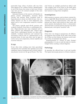 particularly large colony of plasma cells may form
what appears to be a solitary tumour (plasmacytoma)
in one of the bones, but sooner or later most of these
cases turn out to be unusual examples of the same
widespread disease.
Associated features of the marrow-cell disorder are
plasma protein abnormalities, increased blood
viscosity and anaemia. Bone resorption leads to
hypercalcaemia in about one-third of cases. Late sec-
ondary features are due to renal dysfunction and
spinal cord or root compression caused by vertebral
collapse.
The patient, typically aged 45–65, presents with
weakness, backache, bone pain or a pathological frac-
ture. Hypercalcaemia may cause symptoms such as
thirst, polyuria and abdominal pain. Clinical signs
(apart from a pathological fracture) are often unre-
markable. Localized tenderness and restricted hip
movements could be due to a plasmacytoma in the
proximal femur. In late cases there may be signs of
cord or nerve root compression, chronic nephritis and
recurrent infection.
X-rays
X-rays often show nothing more than generalized
osteoporosis; but remember that myeloma is one of the
commonest causes of osteoporosis and vertebral compres-
sion fracture in men over the age of 45 years. The ‘clas-
sical’ lesions are multiple punched-out defects with
‘soft’ margins (lack of new bone) in the skull, pelvis
and proximal femur, a crushed vertebra, or a solitary
lytic tumour in a large-bone metaphysis.
Investigations
Mild anaemia is common, and an almost constant fea-
ture is a high ESR. Blood chemistry may show a raised
creatinine level and hypercalcaemia. Over half the
patients have Bence Jones protein in their urine, and
serum protein electrophoresis shows a characteristic
abnormal band. A sternal marrow puncture may show
plasmacytosis, with typical ‘myeloma’ cells.
Diagnosis
If the only x-ray change is osteoporosis, the differen-
tial diagnosis must include all the other causes of bone
loss. If there are lytic lesions, the features can be simi-
lar to those of metastatic bone disease.
Paraproteinaemia is a feature of other (benign)
gammopathies; it is wise to seek the help of a haema-
tologist before reaching a clinical diagnosis.
Pathology
At operation the affected bone is soft and crumbly.
The typical microscopic picture is of sheets of plasma-
GENERALORTHOPAEDICS
214
9
9.37 Myeloma The characteristic x-ray features are bone rarefaction, vertebral compression fractures, expanding lesions
(typically in the ribs and pelvis) and punched-out areas in the skull and the long bones.
 