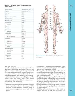 GAIT AND POSTURE
A single gait cycle consists of a stance phase (60 per
cent) and a swing phase (40 per cent) and each full
cycle represents the stride length. Many parameters of
each phase at each joint and in all three planes (coro-
nal, sagittal and transverse) can be analysed, often
using a computerized gait analysis facility. However,
much can be learnt by carefully studying the way the
patient walks and moves; clinical gait analysis
improves with experience and allows distinctive move-
ment patterns to be recognized:
• Dystonia – This term refers to abnormal posturing
(focal or generalized) that may affect any part of the
body and is often aggravated when the patient is
concentrating on a particular motor task such as
walking.
• Antalgic gait – A markedly shortened stance phase
on one side. Pain makes the patient move off the
affected limb as quickly as possible.
• Spastic gait – A stiff-legged gait, often with a
crouching posture (ﬂexed hips and knees and feet in
equinus) and ‘scissoring’ (legs crossing each other),
due to muscle imbalance.
• Drop-foot gait – During swing, the foot ‘drops’ into
equinus; if the foot was not lifted higher than usual
the toes would drag along the ﬂoor. This is caused
by disorder or damage to the peripheral nerves sup-
plying the foot dorsiﬂexors.
• High-stepping gait – This could be due to a bilateral
foot drop or it may signify problems with balance
or proprioception.
• Waddling (Trendelenburg) gait – The trunk is
thrown from side to side with each step. The
Neuromusculardisorders
229
10Table 10.1 Nerve root supply and actions of main
muscle groups
Sternomastoids Spinal accessory C2, 3, 4
Trapezius Spinal accessory C3, 4
Diaphragm C3, 4, 5
Deltoid C5, 6
Supra- and infraspinatus C5, 6
Serratus anterior C5, 6, 7
Pectoralis major C5, 6, 7, 8
Elbow ﬂexion C5, 6
extension C7
Supination C5, 6
Pronation C6
Wrist ﬂexion C6, (7)
extension C6, 7, (8)
Finger ﬂexion C7, 8, T1
extension C7, 8, T1
ab- and adduction C8, T1
Hip ﬂexion L1, 2, 3
extension L5,S1
adduction L2, 3, 4
abduction L4, 5, S1
Knee extension L(2), 3, 4
ﬂexion L5, S1
Ankle dorsiﬂexion L4, 5
plantarﬂexion S1, 2
inversion L4, 5
eversion L5, S1
Toe extension L5
ﬂexion S1
abduction S1, 2
10.5 Examination Dermatomes supplied by the spinal
nerve roots.
 