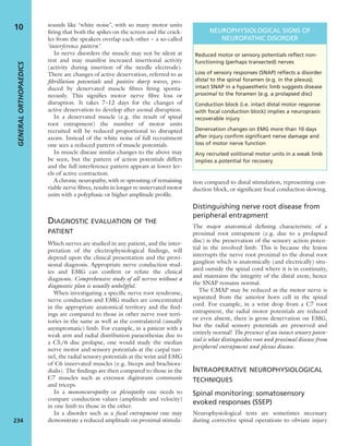 sounds like ‘white noise’, with so many motor units
ﬁring that both the spikes on the screen and the crack-
les from the speakers overlap each other – a so-called
‘interference pattern’.
In nerve disorders the muscle may not be silent at
rest and may manifest increased insertional activity
(activity during insertion of the needle electrode).
There are changes of active denervation, referred to as
ﬁbrillation potentials and positive sharp waves, pro-
duced by denervated muscle ﬁbres ﬁring sponta-
neously. This signiﬁes motor nerve ﬁbre loss or
disruption. It takes 7–12 days for the changes of
active denervation to develop after axonal disruption.
In a denervated muscle (e.g. the result of spinal
root entrapment) the number of motor units
recruited will be reduced proportional to disrupted
axons. Instead of the white noise of full recruitment
one sees a reduced pattern of muscle potentials.
In muscle disease similar changes to the above may
be seen, but the pattern of action potentials differs
and the full interference pattern appears at lower lev-
els of active contraction.
A chronic neuropathy, with re-sprouting of remaining
viable nerve ﬁbres, results in longer re-innervated motor
units with a polyphasic or higher amplitude proﬁle.
DIAGNOSTIC EVALUATION OF THE
PATIENT
Which nerves are studied in any patient, and the inter-
pretation of the electrophysiological ﬁndings, will
depend upon the clinical presentation and the provi-
sional diagnosis. Appropriate nerve conduction stud-
ies and EMG can conﬁrm or refute the clinical
diagnosis. Comprehensive study of all nerves without a
diagnostic plan is usually unhelpful.
When investigating a speciﬁc nerve root syndrome,
nerve conduction and EMG studies are concentrated
in the appropriate anatomical territory and the ﬁnd-
ings are compared to those in other nerve root terri-
tories in the same as well as the contralateral (usually
asymptomatic) limb. For example, in a patient with a
weak arm and radial distribution paraesthesiae due to
a C5/6 disc prolapse, one would study the median
nerve motor and sensory potentials at the carpal tun-
nel, the radial sensory potentials at the wrist and EMG
of C6 innervated muscles (e.g. biceps and brachiora-
dialis). The ﬁndings are then compared to those in the
C7 muscles such as extensor digitorum communis
and triceps.
In a mononeuropathy or plexopathy one needs to
compare conduction values (amplitude and velocity)
in one limb to those in the other.
In a disorder such as a focal entrapment one may
demonstrate a reduced amplitude on proximal stimula-
tion compared to distal stimulation, representing con-
duction block, or signiﬁcant focal conduction slowing.
Distinguishing nerve root disease from
peripheral entrapment
The major anatomical deﬁning characteristic of a
proximal root entrapment (e.g. due to a prolapsed
disc) is the preservation of the sensory action poten-
tial in the involved limb. This is because the lesion
interrupts the nerve root proximal to the dorsal root
ganglion which is anatomically (and electrically) situ-
ated outside the spinal cord where it is in continuity,
and maintains the integrity of the distal axon; hence
the SNAP remains normal.
The CMAP may be reduced as the motor nerve is
separated from the anterior horn cell in the spinal
cord. For example, in a wrist drop from a C7 root
entrapment, the radial motor potentials are reduced
or even absent, there is gross denervation on EMG,
but the radial sensory potentials are preserved and
entirely normal! The presence of an intact sensory poten-
tial is what distinguishes root and proximal disease from
peripheral entrapment and plexus disease.
INTRAOPERATIVE NEUROPHYSIOLOGICAL
TECHNIQUES
Spinal monitoring: somatosensory
evoked responses (SSEP)
Neurophysiological tests are sometimes necessary
during corrective spinal operations to obviate injury
GENERALORTHOPAEDICS
234
10 NEUROPHYSIOLOGICAL SIGNS OF
NEUROPATHIC DISORDER
Reduced motor or sensory potentials reﬂect non-
functioning (perhaps transected) nerves
Loss of sensory responses (SNAP) reﬂects a disorder
distal to the spinal foramen (e.g. in the plexus);
intact SNAP in a hypaesthetic limb suggests disease
proximal to the foramen (e.g. a prolapsed disc)
Conduction block (i.e. intact distal motor response
with focal conduction block) implies a neuropraxic
recoverable injury
Denervation changes on EMG more than 10 days
after injury conﬁrm signiﬁcant nerve damage and
loss of motor nerve function
Any recruited volitional motor units in a weak limb
implies a potential for recovery
 