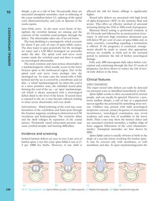 dimple, a pit or a tuft of hair. Occasionally there are
associated intraspinal anomalies, such as tethering of
the conus medullaris below L1, splitting of the spinal
cord (diastematomyelia) and cysts or lipomas of the
cauda equina.
Spina biﬁda cystica In the more overt forms of dys-
raphism the vertebral laminae are missing and the
contents of the vertebral canal prolapse through the
defect. The abnormality takes one of several forms.
The least disabling is a meningocele, which accounts
for about 5 per cent of cases of spina biﬁda cystica.
The dura mater is open posteriorly but the meninges
are intact and a CSF-ﬁlled meningeal sac protrudes
under the skin. The spinal cord and nerve roots
remain inside the vertebral canal and there is usually
no neurological abnormality.
The most common and most serious abnormality is
a myelomeningocele, which usually occurs in the lower
thoracic spine or the lumbosacral region. Part of the
spinal cord and nerve roots prolapse into the
meningeal sac. In some cases the neural tube is fully
formed and the sac is covered by a membrane and/or
skin – a ‘closed’ myelomeningocele. In others the cord is
in a more primitive state, the unfolded neural plate
forming the roof of the sac – an ‘open’ myelomeningo-
cele which is always associated with a neurological
deﬁcit distal to the level of the lesion. If neural tissue
is exposed to the air, it may become infected, leading
to more severe abnormality and even death.
Hydrocephalus Distal tethering of the cord may cause
herniation of the cerebellum and brain-stem through
the foramen magnum, resulting in obstruction to CSF
circulation and hydrocephalus. The ventricles dilate
and the skull enlarges by separation of the cranial
sutures. Persistently raised intracranial pressure may
cause cerebral atrophy and learning difﬁculties.
Incidence and screening
Isolated laminar defects are seen in over 5 per cent of
lumbar spine x-rays but cystic spina biﬁda is rare at 2–
3 per 1000 live births. However, if one child is
affected the risk for future siblings is signiﬁcantly
higher.
Neural tube defects are associated with high levels
of alpha-fetoprotein (AFP) in the amniotic ﬂuid and
serum. This offers an effective method of antenatal
screening during the 15th to 18th week of pregnancy.
Maternal blood testing is performed routinely at
15–18 weeks and followed by an amniocentesis if nec-
essary. A mid-term high resolution ultrasound scan
will detect 95 per cent of cases of spina biﬁda and, in
many countries, counselling regarding a termination
is offered. If the pregnancy is continued, arrange-
ments should be made to ensure that appropriate
services are available at birth and in the neonatal
period to minimize the risk of further neurological
damage.
Folic acid, 400 micrograms daily taken before con-
ception and continuing through the ﬁrst 12 weeks of
pregnancy, has been shown to reduce the risk of neu-
ral tube defects in the fetus.
Clinical features
EARLY DIAGNOSIS
The major neural tube defects can easily be detected
on antenatal scans or identiﬁed immediately at birth.
Spina biﬁda occulta is often encountered in normal
people, and can usually be ignored. However, a pos-
terior midline dimple, a tuft of hair or a pigmented
naevus signiﬁes the potential for something more seri-
ous. Children may present with mild neurological
symptoms: enuresis, urinary frequency or intermittent
incontinence; neurological examination may reveal
weakness and some loss of sensibility in the lower
limbs. Plain x-rays may show the laminar defect and
any associated vertebral anomalies; a midline ridge of
bone suggests bifurcation of the cord (diastemato-
myelia). Intraspinal anomalies are best shown by
MRI.
Spina biﬁda cystica is usually obvious at birth in the
shape of a saccular lesion overlying the lumbar spine.
It may be covered only with membrane, or with
membrane and skin. In open myelomeningoceles the
GENERALORTHOPAEDICS
248
10
10.17 Dysraphism (a) Spina biﬁda occulta. (b) Meningocele. (c) Myelomeningocele. (d) Open myelomeningocele.
(a) (b) (c) (d)
 