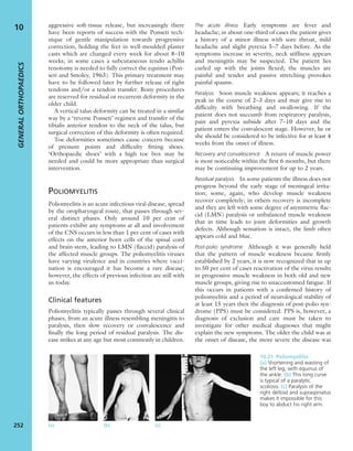 aggressive soft-tissue release, but increasingly there
have been reports of success with the Ponseti tech-
nique of gentle manipulation towards progressive
correction, holding the feet in well-moulded plaster
casts which are changed every week for about 8–10
weeks; in some cases a subcutaneous tendo achillis
tenotomy is needed to fully correct the equinus (Pon-
seti and Smoley, 1963). This primary treatment may
have to be followed later by further release of tight
tendons and/or a tendon transfer. Bony procedures
are reserved for residual or recurrent deformity in the
older child.
A vertical talus deformity can be treated in a similar
way by a ‘reverse Ponseti’ regimen and transfer of the
tibialis anterior tendon to the neck of the talus, but
surgical correction of this deformity is often required.
Toe deformities sometimes cause concern because
of pressure points and difﬁculty ﬁtting shoes.
‘Orthopaedic shoes’ with a high toe box may be
needed and could be more appropriate than surgical
intervention.
POLIOMYELITIS
Poliomyelitis is an acute infectious viral disease, spread
by the oropharyngeal route, that passes through sev-
eral distinct phases. Only around 10 per cent of
patients exhibit any symptoms at all and involvement
of the CNS occurs in less than 1 per cent of cases with
effects on the anterior horn cells of the spinal cord
and brain-stem, leading to LMN (ﬂaccid) paralysis of
the affected muscle groups. The poliomyelitis viruses
have varying virulence and in countries where vacci-
nation is encouraged it has become a rare disease;
however, the effects of previous infection are still with
us today.
Clinical features
Poliomyelitis typically passes through several clinical
phases, from an acute illness resembling meningitis to
paralysis, then slow recovery or convalescence and
ﬁnally the long period of residual paralysis. The dis-
ease strikes at any age but most commonly in children.
The acute illness Early symptoms are fever and
headache; in about one-third of cases the patient gives
a history of a minor illness with sore throat, mild
headache and slight pyrexia 5–7 days before. As the
symptoms increase in severity, neck stiffness appears
and meningitis may be suspected. The patient lies
curled up with the joints ﬂexed; the muscles are
painful and tender and passive stretching provokes
painful spasms.
Paralysis Soon muscle weakness appears; it reaches a
peak in the course of 2–3 days and may give rise to
difﬁculty with breathing and swallowing. If the
patient does not succumb from respiratory paralysis,
pain and pyrexia subside after 7–10 days and the
patient enters the convalescent stage. However, he or
she should be considered to be infective for at least 4
weeks from the onset of illness.
Recovery and convalescence A return of muscle power
is most noticeable within the ﬁrst 6 months, but there
may be continuing improvement for up to 2 years.
Residual paralysis In some patients the illness does not
progress beyond the early stage of meningeal irrita-
tion; some, again, who develop muscle weakness
recover completely; in others recovery is incomplete
and they are left with some degree of asymmetric ﬂac-
cid (LMN) paralysis or unbalanced muscle weakness
that in time leads to joint deformities and growth
defects. Although sensation is intact, the limb often
appears cold and blue.
Post-polio syndrome Although it was generally held
that the pattern of muscle weakness became ﬁrmly
established by 2 years, it is now recognized that in up
to 50 per cent of cases reactivation of the virus results
in progressive muscle weakness in both old and new
muscle groups, giving rise to unaccustomed fatigue. If
this occurs in patients with a conﬁrmed history of
poliomyelitis and a period of neurological stability of
at least 15 years then the diagnosis of post-polio syn-
drome (PPS) must be considered. PPS is, however, a
diagnosis of exclusion and care must be taken to
investigate for other medical diagnoses that might
explain the new symptoms. The older the child was at
the onset of disease, the more severe the disease was
GENERALORTHOPAEDICS
252
10
10.21 Poliomyelitis
(a) Shortening and wasting of
the left leg, with equinus of
the ankle. (b) This long curve
is typical of a paralytic
scoliosis. (c) Paralysis of the
right deltoid and supraspinatus
makes it impossible for this
boy to abduct his right arm.
(a) (b) (c)
 
