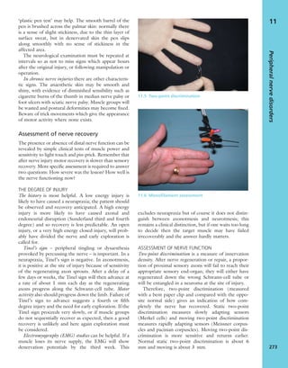‘plastic pen test’ may help. The smooth barrel of the
pen is brushed across the palmar skin: normally there
is a sense of slight stickiness, due to the thin layer of
surface sweat, but in denervated skin the pen slips
along smoothly with no sense of stickiness in the
affected area.
The neurological examination must be repeated at
intervals so as not to miss signs which appear hours
after the original injury, or following manipulation or
operation.
In chronic nerve injuries there are other characteris-
tic signs. The anaesthetic skin may be smooth and
shiny, with evidence of diminished sensibility such as
cigarette burns of the thumb in median nerve palsy or
foot ulcers with sciatic nerve palsy. Muscle groups will
be wasted and postural deformities may become ﬁxed.
Beware of trick movements which give the appearance
of motor activity where none exists.
Assessment of nerve recovery
The presence or absence of distal nerve function can be
revealed by simple clinical tests of muscle power and
sensitivity to light touch and pin-prick. Remember that
after nerve injury motor recovery is slower than sensory
recovery. More speciﬁc assessment is required to answer
two questions: How severe was the lesion? How well is
the nerve functioning now?
THE DEGREE OF INJURY
The history is most helpful. A low energy injury is
likely to have caused a neurapraxia; the patient should
be observed and recovery anticipated. A high energy
injury is more likely to have caused axonal and
endoneurial disruption (Sunderland third and fourth
degree) and so recovery is less predictable. An open
injury, or a very high energy closed injury, will prob-
ably have divided the nerve and early exploration is
called for.
Tinel’s sign – peripheral tingling or dysaesthesia
provoked by percussing the nerve – is important. In a
neurapraxia, Tinel’s sign is negative. In axonotmesis,
it is positive at the site of injury because of sensitivity
of the regenerating axon sprouts. After a delay of a
few days or weeks, the Tinel sign will then advance at
a rate of about 1 mm each day as the regenerating
axons progress along the Schwann-cell tube. Motor
activity also should progress down the limb. Failure of
Tinel’s sign to advance suggests a fourth or ﬁfth
degree injury and the need for early exploration. If the
Tinel sign proceeds very slowly, or if muscle groups
do not sequentially recover as expected, then a good
recovery is unlikely and here again exploration must
be considered.
Electromyography (EMG) studies can be helpful. If a
muscle loses its nerve supply, the EMG will show
denervation po