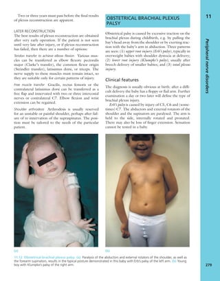 Apley's shoulderjt examination