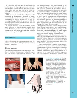 Apley's shoulderjt examination