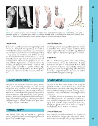 Apley's shoulderjt examination