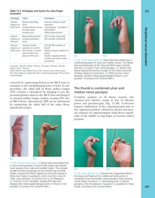 Apley's shoulderjt examination