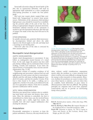 Apley's shoulderjt examination
