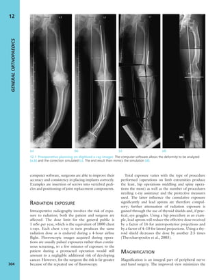 Apley's shoulderjt examination