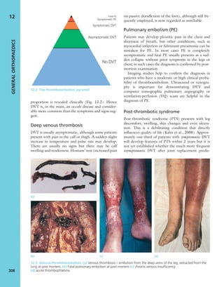 Apley's shoulderjt examination