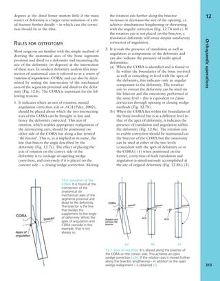 Apley's shoulderjt examination