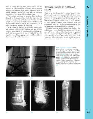 Apley's shoulderjt examination